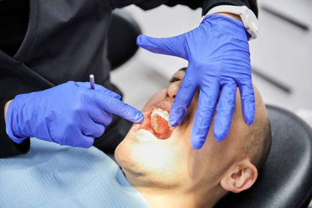 Best Emergency Tooth Extraction in Sunnyvale, TX